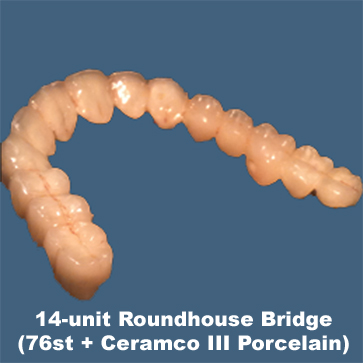 14-unit ROundhouse Bridge